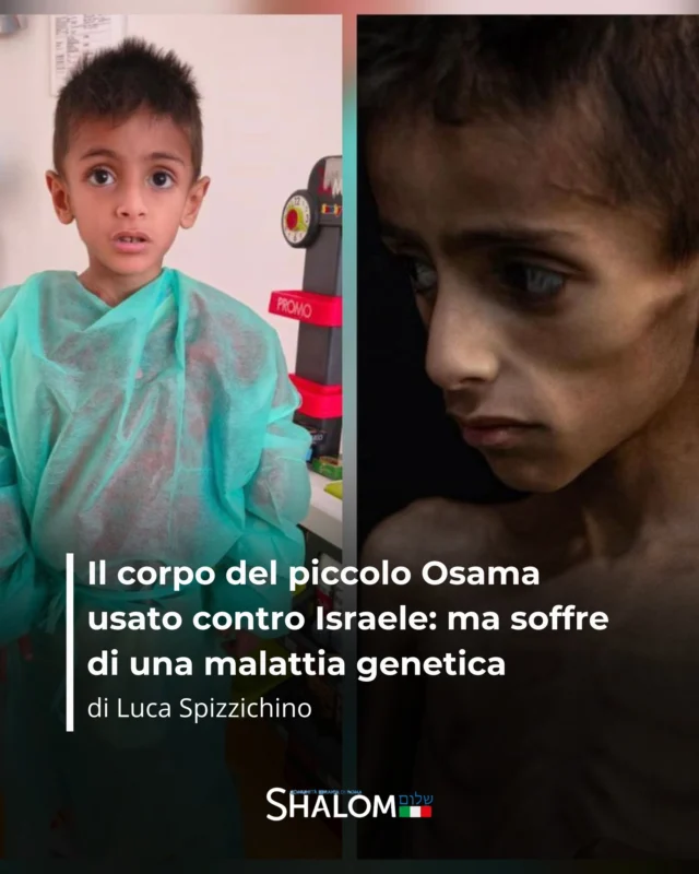 È diventata virale in tutto il mondo la fotografia del piccolo Osama, il bambino palestinese mostrato denutrito e sofferente, usata per attaccare Israele. Ma la realtà è un’altra: Osama soffre di fibrosi cistica.

Leggi di più nell'articolo di @luca.spizz su Shalom.it