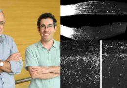 La scienza al Weizmann non si ferma: scoperte molecole di RNA in grado di rigenerare i nervi