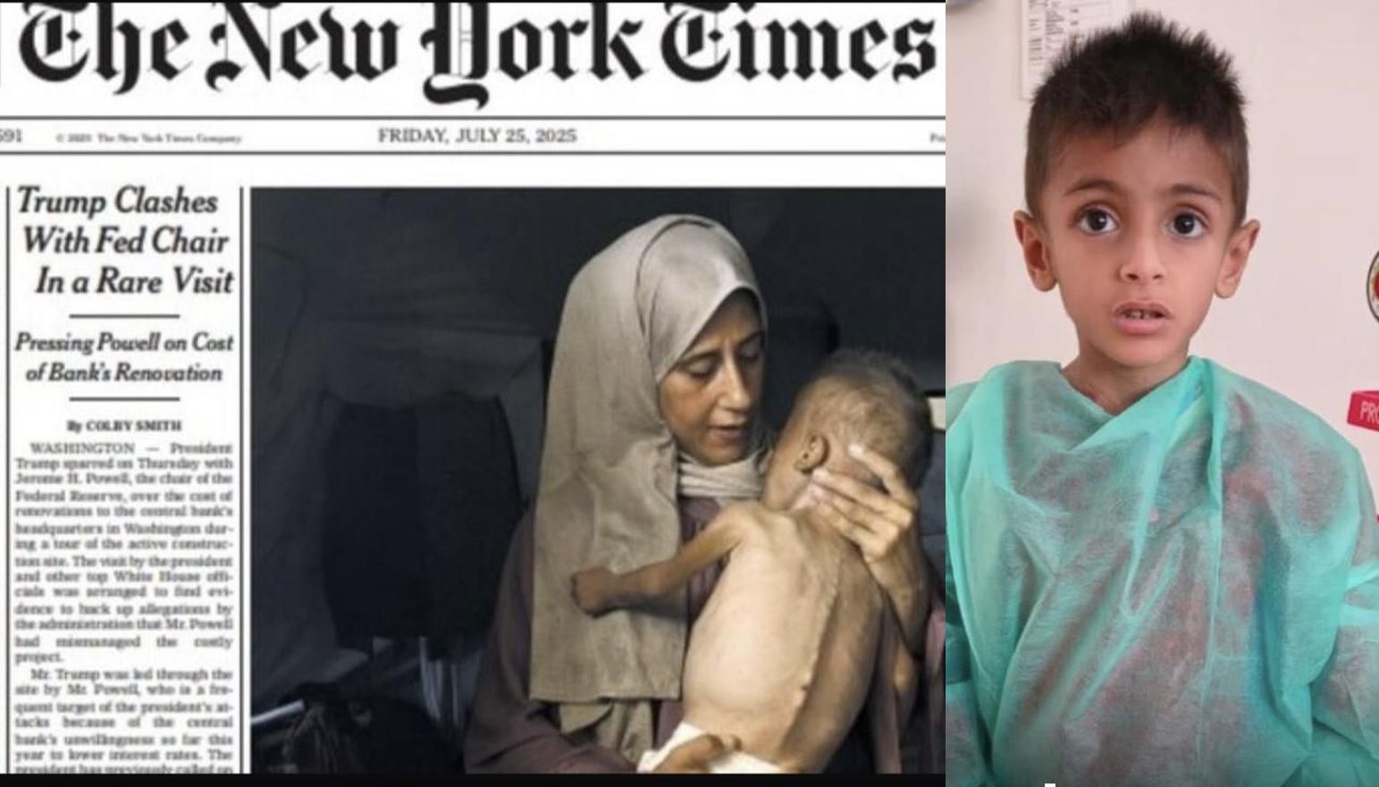 Il caso del bambino di Gaza. Il New York Times ammette l'errore ma ormai è troppo tardi