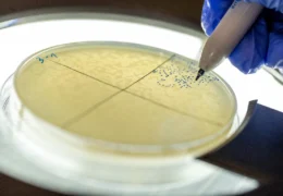 Ricerca israeliana: scoperta una molecola di RNA per combattere i batteri resistenti agli antibiotici