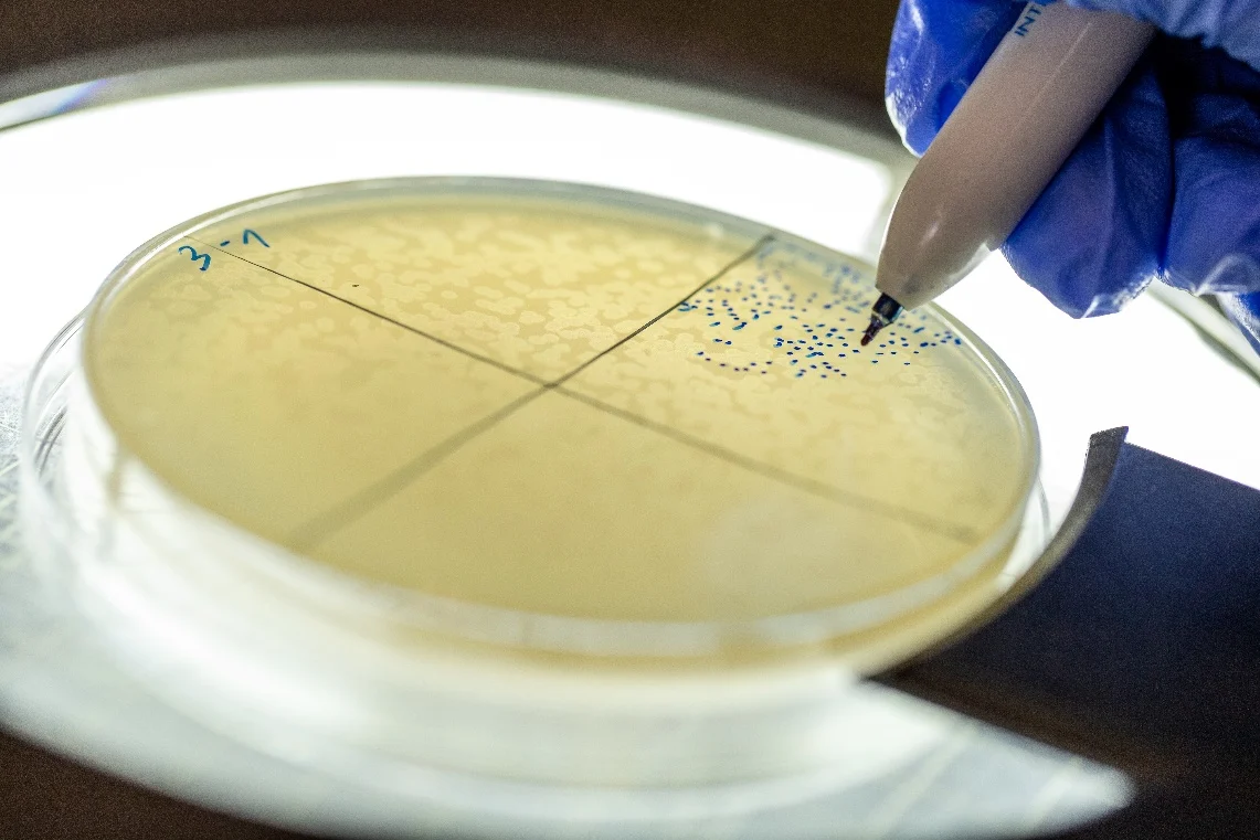 Ricerca israeliana: scoperta una molecola di RNA per combattere i batteri resistenti agli antibiotici